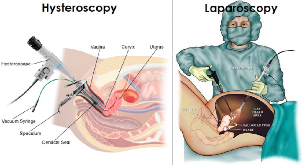 Hysteroscopy / Laparoscopy Clinic In Jaipur 