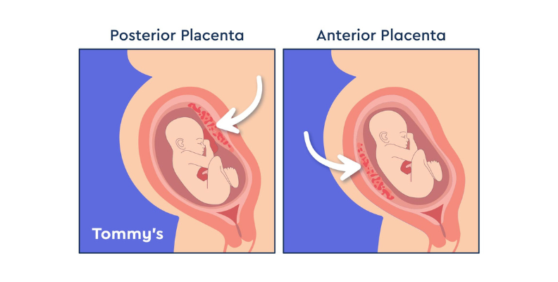 Anterior vs Posterior Placenta, What is the Difference?