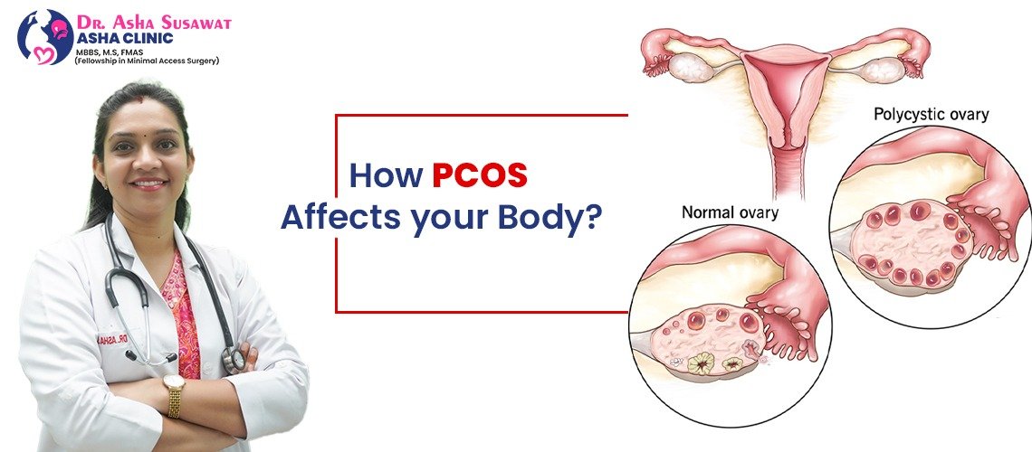 How PCOS affects your body?