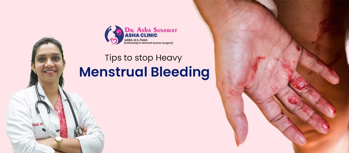 Tips to stop Heavy Menstrual Bleeding